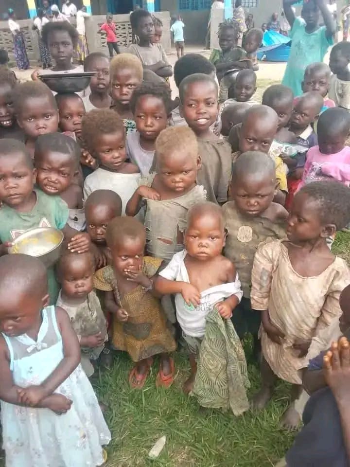 Pénurie alimentaire à Walungu, Kabare et Kalehe : Les ONG locales alertent sur des cas de malnutrition aiguë